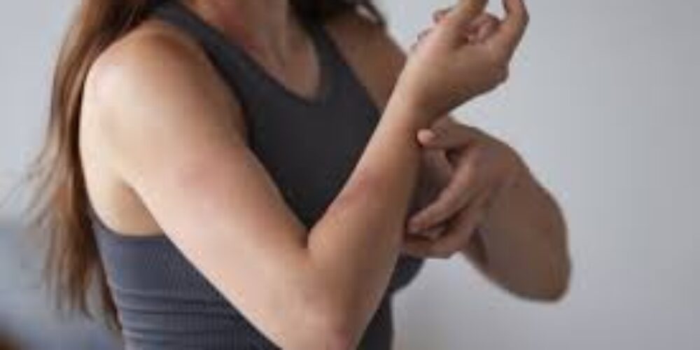 Doenças que o mosquito da dengue transmite