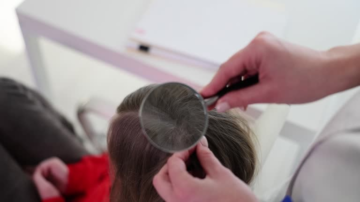 Qual é a diferença entre piolhos e lêndeas