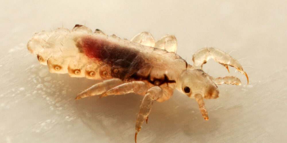 Quanto tempo dura um piolho na cabeça