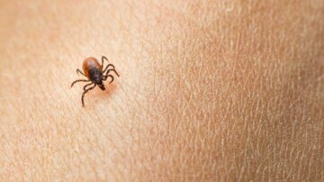 Todos os carrapatos transmitem a doença de Lyme