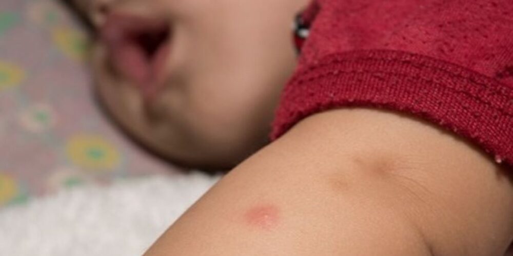 Tratamento infantil da dengue